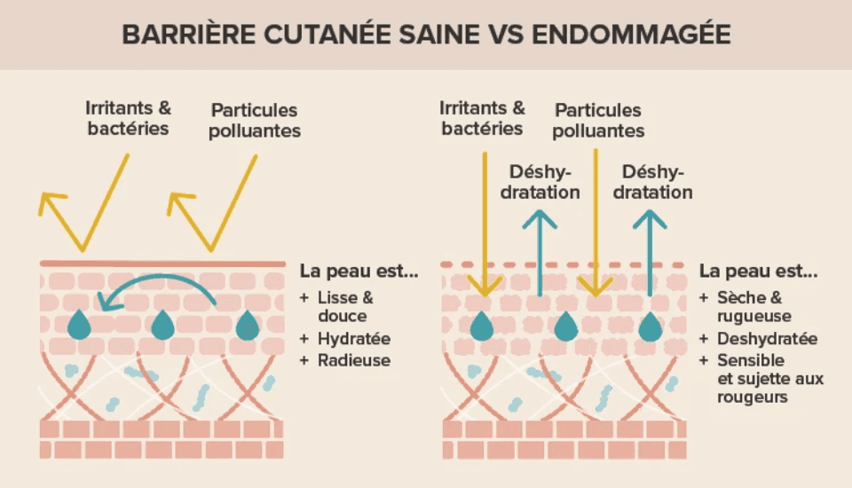 Schéma comparant une barrière cutanée saine et une barrière endommagée